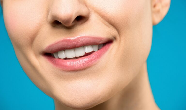 natural teeth whitening